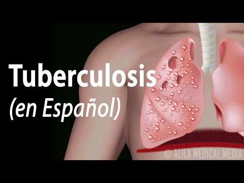 La historia de la tuberculosis en México: Un legado de lucha y superación